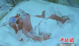 分娩过程视频,揭秘母爱奇迹的瞬间